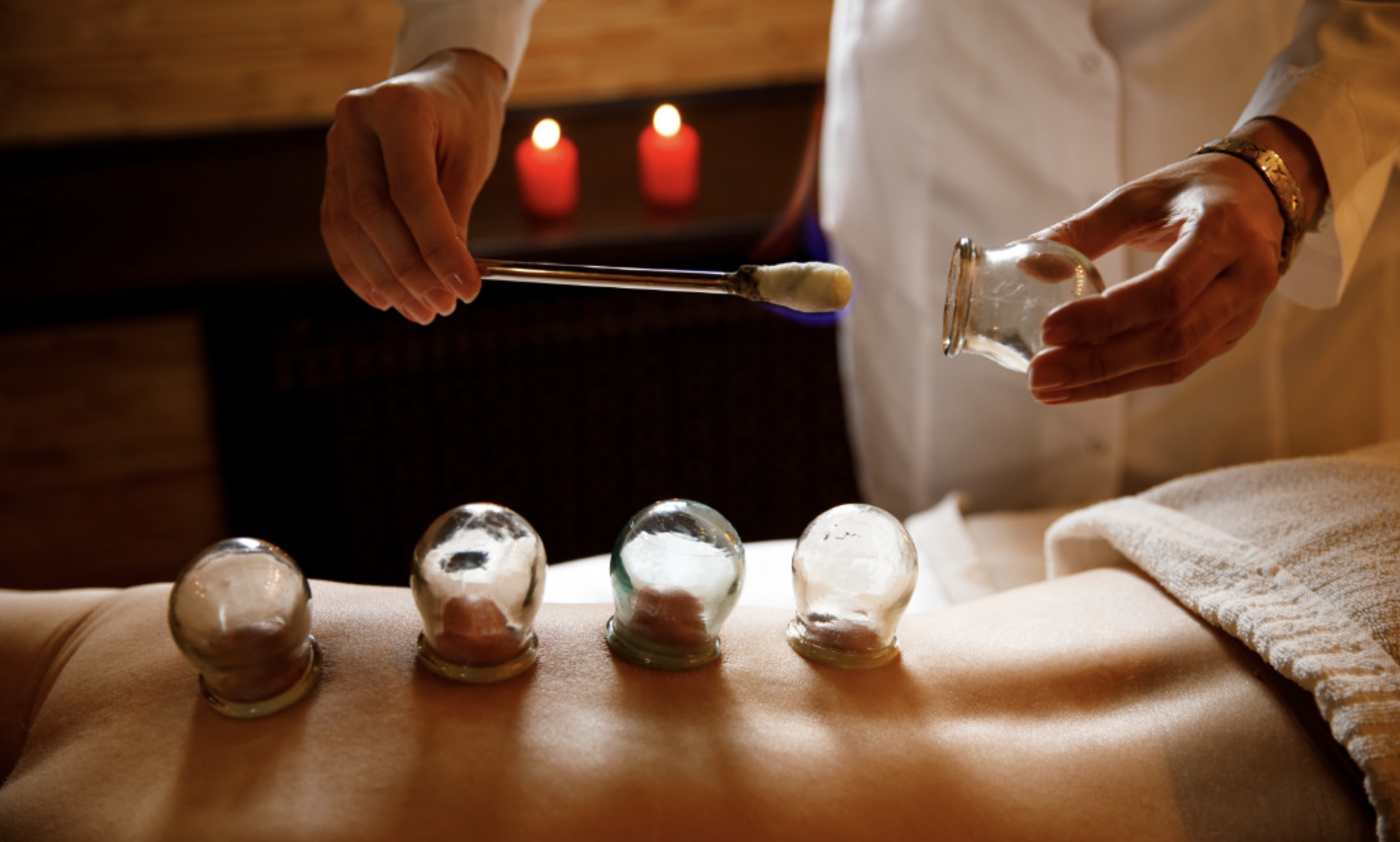 Ventouses Chinoises Montauban