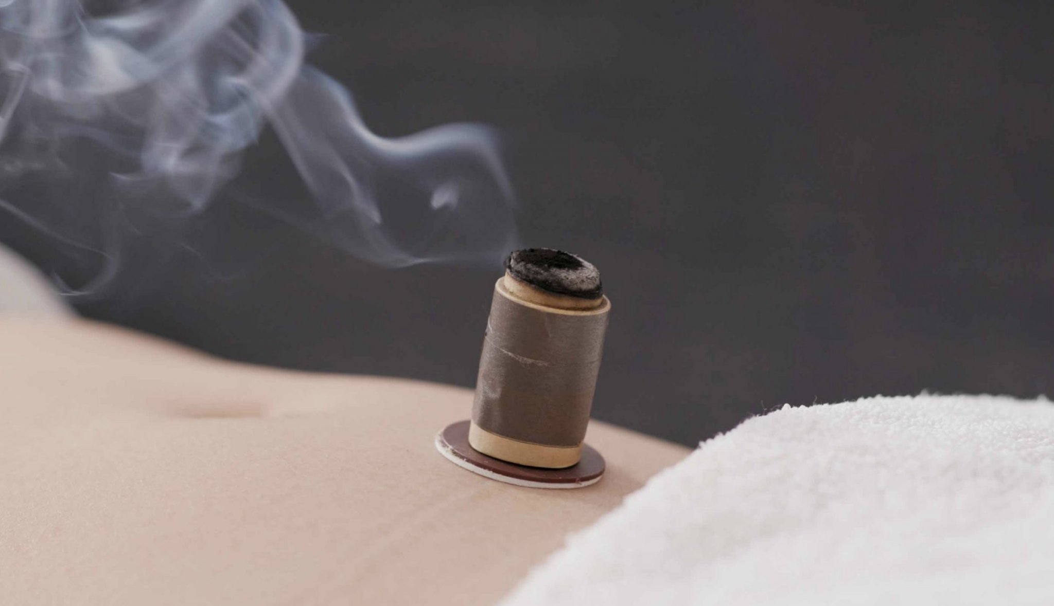 Moxibustion Eduardo Navarro Montauban