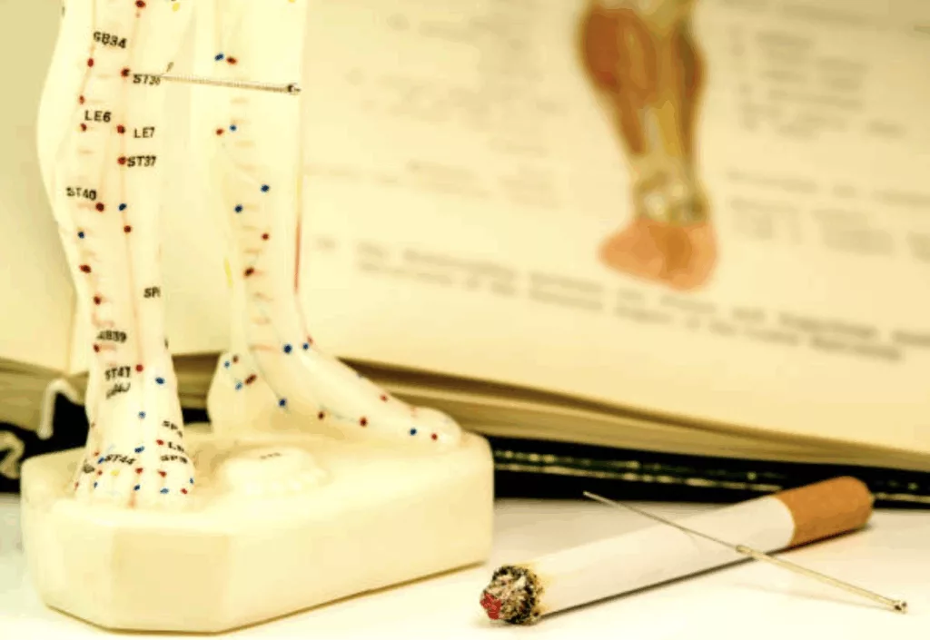 L'arrêt du tabac grâce à l'acupuncture, praticien Eduardo Navarro 82