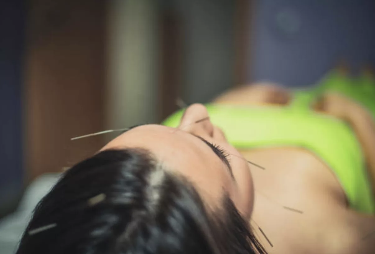 Traitement des sinusites par acupuncture Montauban