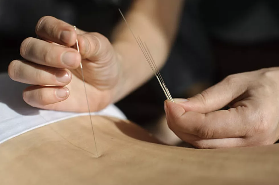 Traitement des allergies par acupuncture à Montauban Tarn-et-Garonne